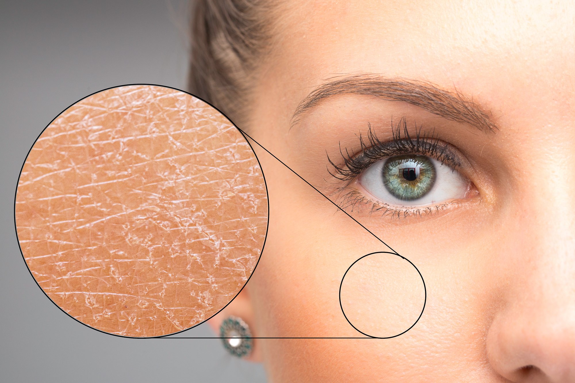 Skin assessments