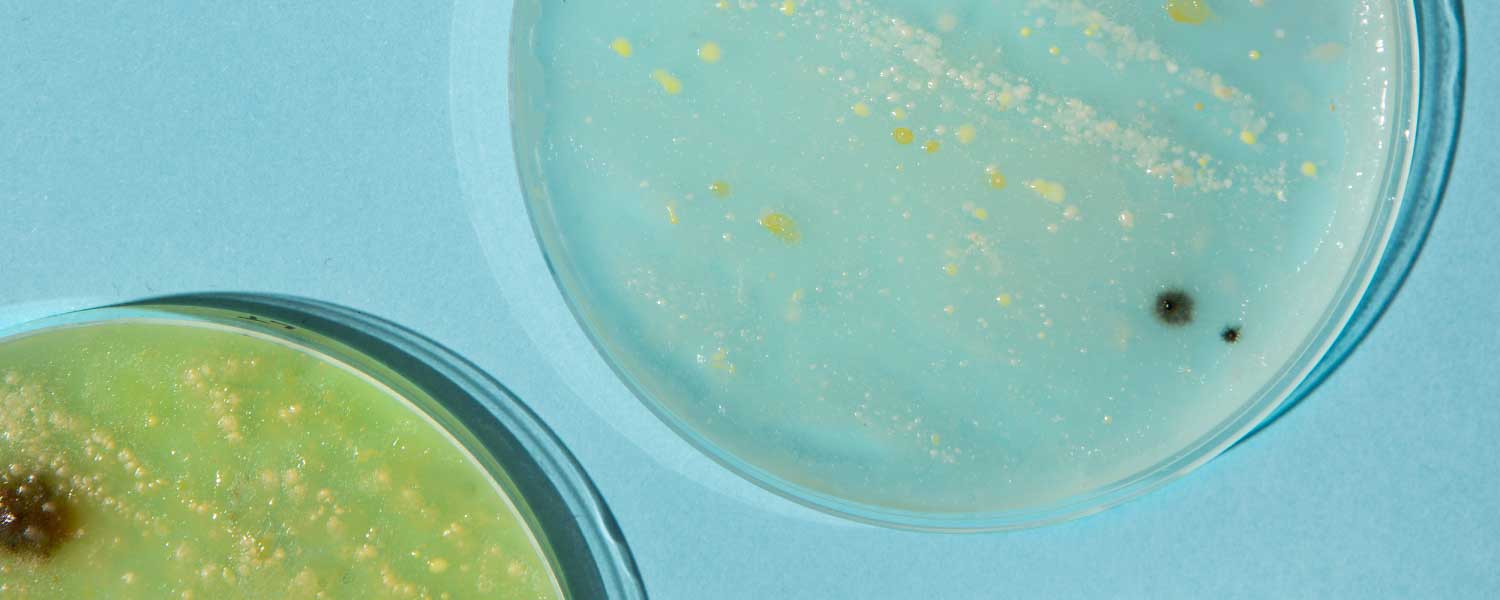 Human Skin Microbiota: Antimicrobial Potential